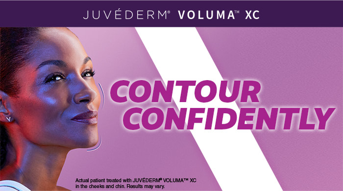 Juvederm Voluma XC in the cheeks and chin approved by FDA Black woman 'Contour Confidently'